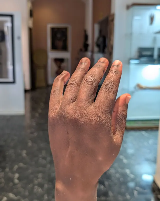 Naija Don Do Am Again! Nigerian-Made Bionic Arm Enter TIME Magazine Best Inventions of 2026 List